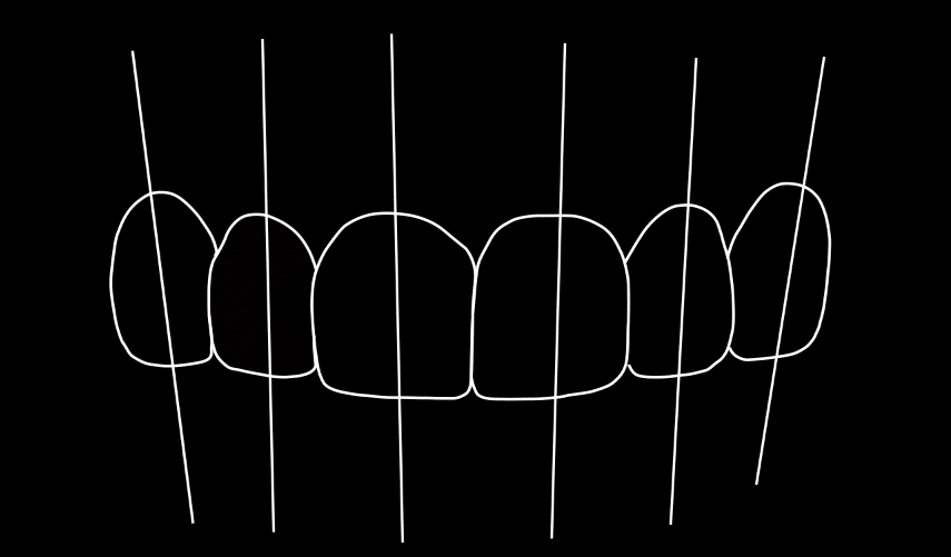 Upload your photos for a free consultation